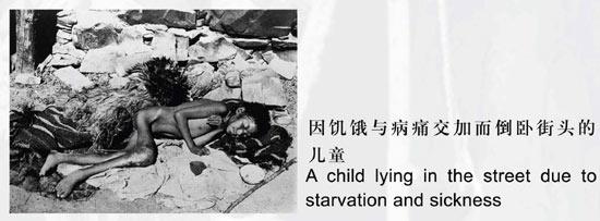 因饑餓與病痛交加而倒臥街頭的兒童