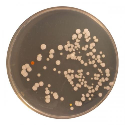 研究發現的大部分微生物種類都屬於微球菌屬（Micrococcus），為放線菌的種類。
