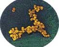 金黃色葡萄球菌可引起肺炎