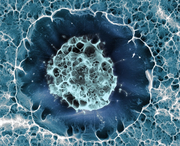 This human stem cell is just 15 micrometres across, and was false-coloured after being imaged using cryogenic scanning electron microscopy.