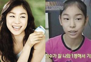 The photo posted above purports to show Kim Yuna before (R) and after (L). Rumor spreads that Kim Yuna had a facial plastic surgery to make her more beautiful and more attractive as she twist and turn on the solid ice. This beautiful, sexy Kim Yuna is the Vancouver Winter Olympics 2010 gold medalist. (File Photo)