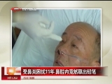 <a href=http://big5.cctv.com/gate/big5/news.cntv.cn/society/20110913/105683.shtml target=_blank>[匯説天下]受鼻炎困擾11年 鼻腔內竟然取出鉛筆</a>