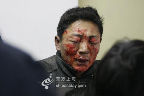 上海南匯區爆炸中一名傷者滿臉是血（東方網 圖）