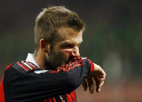 David Beckham is expected to miss the World Cup after apparently tearing his Achilles’tendon while playing for A.C. Milan on Sunday.