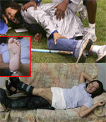 2007年夏季，在巴西聖保羅進行的“巴西杯”全國田徑冠軍賽上，一名標槍運動員在熱身時將投出的標槍刺穿了裁判洛倫索的腳。洛倫索隨後被送往醫院進行手術。