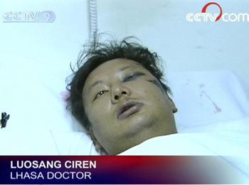 At least 10 people in this hospital are receiving treatment for wounds because of the riots. One of them, a Tibetan doctor, was hurt on Friday as he tried to help others.