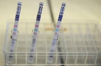 Flu tests strips can be seen in a laboratory. (AFP/DDP/File/Nigel Treblin)