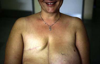 Vasiliki Kostoula, a Greek breast cancer patient, smiles after a radiological medical examination in an Athens hospital October 29, 2008.(Xinhua/Reuters Photo)