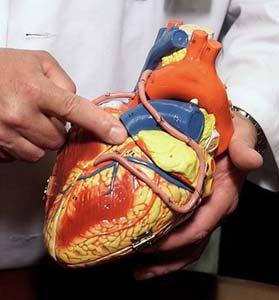 In this file photo, Dr. John Lasala, director of the Cardiac Cath Lab at Barnes-Jewish Hospital, points out one of the three major coronary arteries, the one he ominously refers to as the 'widowmaker,' using a model of the human heart, June 24, 2002 in St. Louis. The pink tubes on the model depict a heart after bypass surgery.[Agencies]