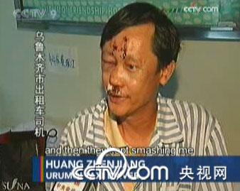 48-year-old Huang Zhenjiang is a taxi driver. He was attacked by the rioters on Sunday night.