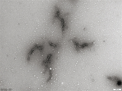 這是使用電子顯微鏡觀察到的來自新冠病毒刺突蛋白的澱粉樣蛋白圖片。當刺突蛋白與試管中的中性粒細胞彈性蛋白酶混合時，會産生分支蛋白纖維，這可能會導致新冠肺炎患者的凝血功能障礙。 圖片來源：《美國化學學會雜誌》